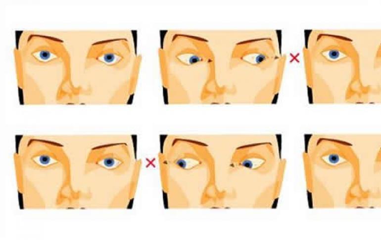 Ako odstrániť ochabnuté líca Skoré príčiny ptózy tváre