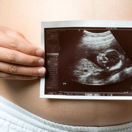जुड़वा बच्चों में भ्रूण-भ्रूण आधान सिंड्रोम: वर्गीकरण और उपचार के विकल्प
